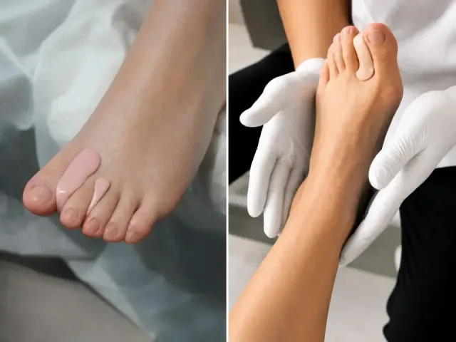 Custom Silicone Toe Orthoses - Podiatry service