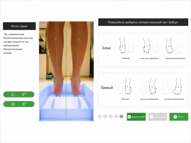 Bone Structure and Foot Biomechanics Diagnostics - 2